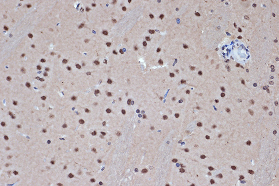 HDAC8 Rabbit monoclonal antibody