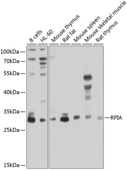 RPIA Rabbit polyclonal antibody