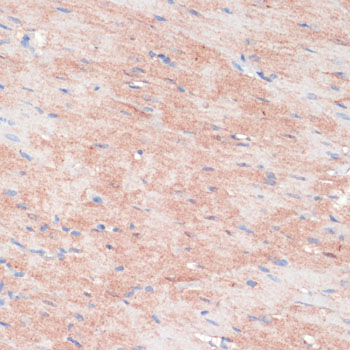 RPIA Rabbit polyclonal antibody