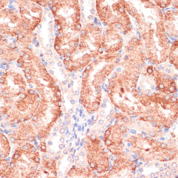 RPIA Rabbit polyclonal antibody