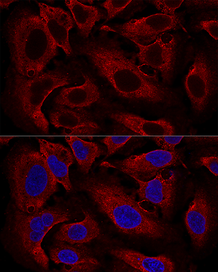ARL8B Rabbit polyclonal antibody