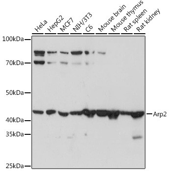 Arp2 Rabbit monoclonal antibody
