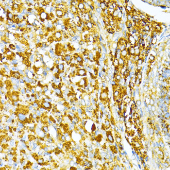 VAMP1 Rabbit polyclonal antibody