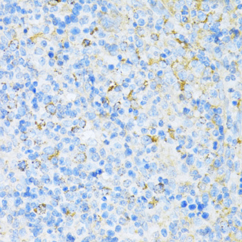 VAMP1 Rabbit polyclonal antibody