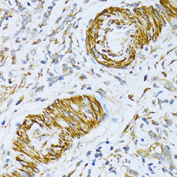 VAMP1 Rabbit polyclonal antibody