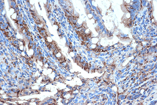 FABPI Rabbit monoclonal antibody