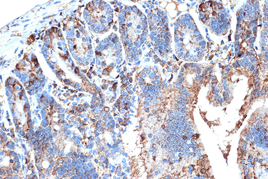 FABPI Rabbit monoclonal antibody