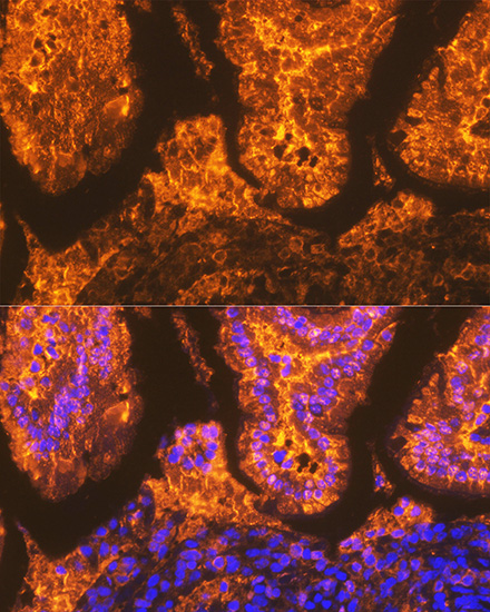 FABPI Rabbit monoclonal antibody