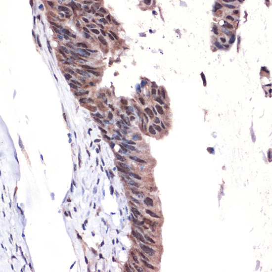 MBD3 Rabbit monoclonal antibody
