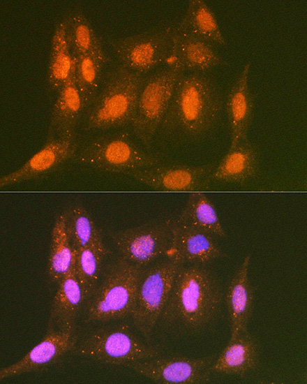 LTA4H Rabbit monoclonal antibody