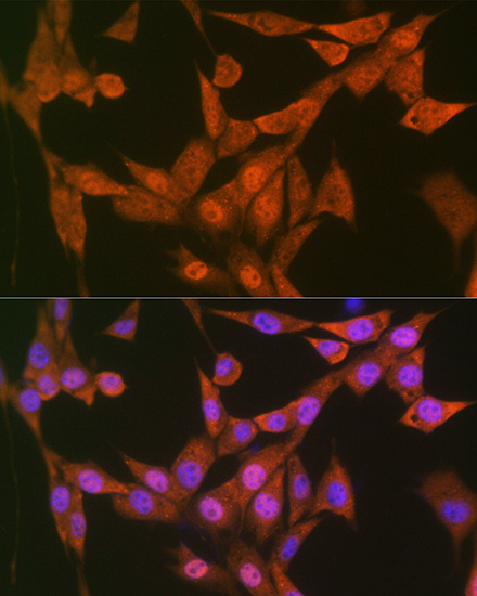 LTA4H Rabbit monoclonal antibody