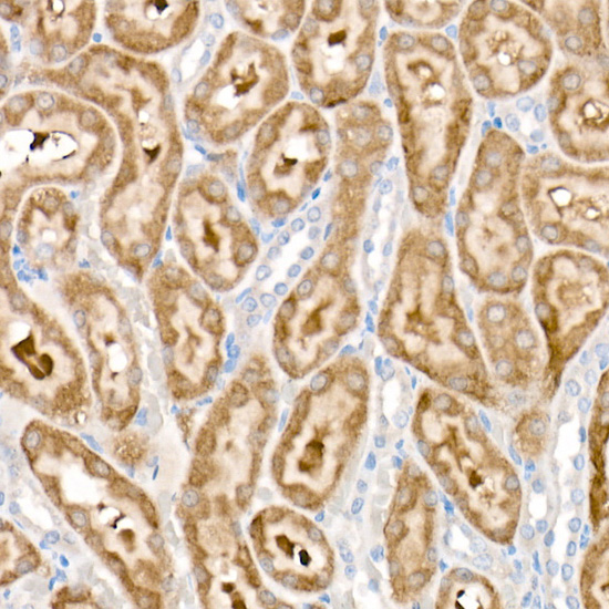 PDK1/PDHK1 Rabbit monoclonal antibody