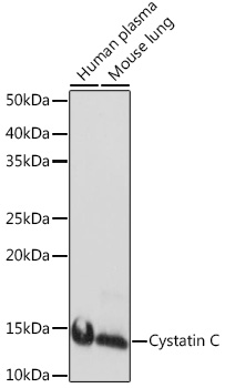 Cystatin C Rabbit monoclonal antibody