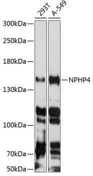 NPHP4 Rabbit polyclonal antibody