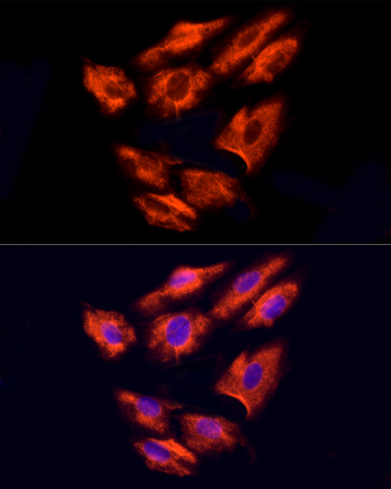 NPHP4 Rabbit polyclonal antibody