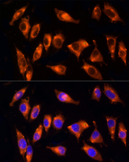 NPHP4 Rabbit polyclonal antibody