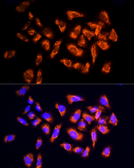 NPHP4 Rabbit polyclonal antibody