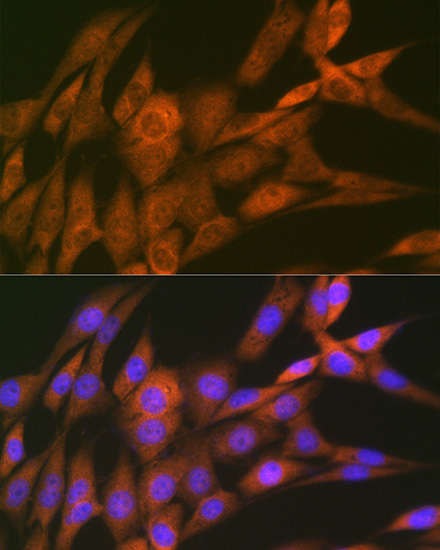 14-3-3 Theta Rabbit monoclonal antibody