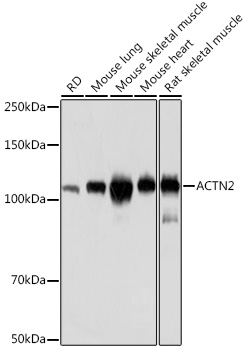 ACTN2 Rabbit monoclonal antibody