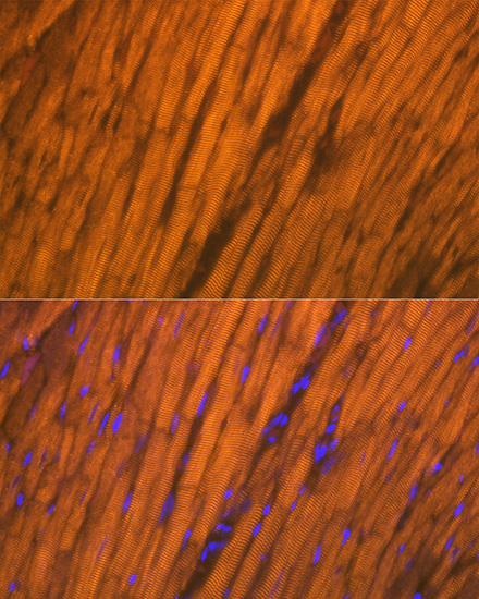 ACTN2 Rabbit monoclonal antibody