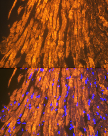 ACTN2 Rabbit monoclonal antibody
