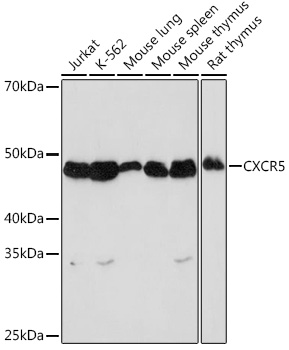 CXCR5 Rabbit monoclonal antibody