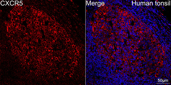 CXCR5 Rabbit monoclonal antibody