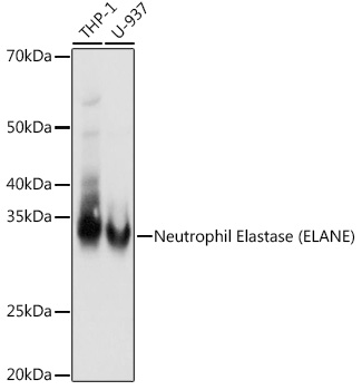 Neutrophil Elastase (ELANE) Rabbit monoclonal antibody