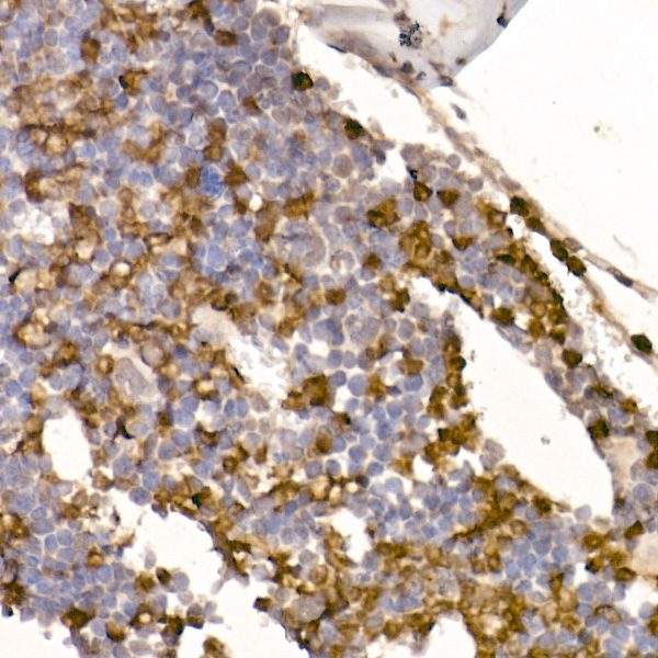 Neutrophil Elastase (ELANE) Rabbit monoclonal antibody