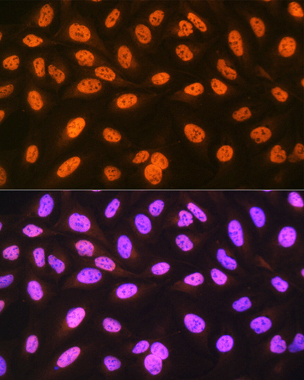 hnRNP C Rabbit monoclonal antibody