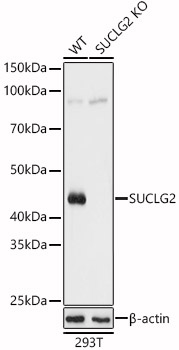 [KO Validated] SUCLG2 Rabbit polyclonal antibody