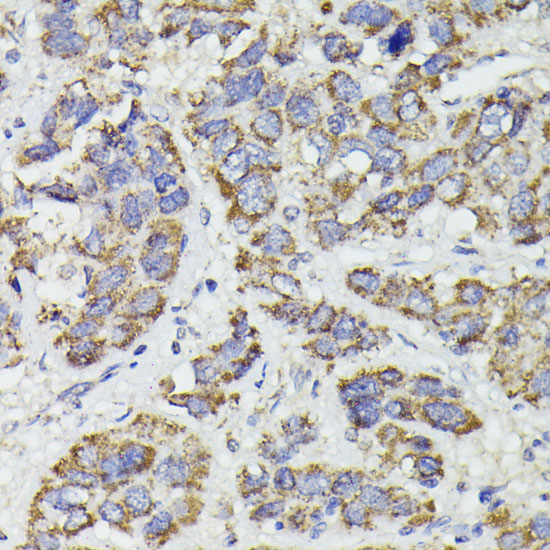 [KO Validated] SUCLG2 Rabbit polyclonal antibody