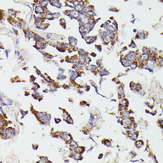 [KO Validated] SUCLG2 Rabbit polyclonal antibody