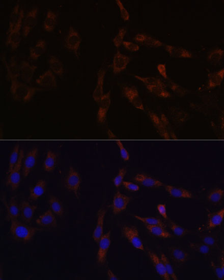 [KO Validated] SUCLG2 Rabbit polyclonal antibody
