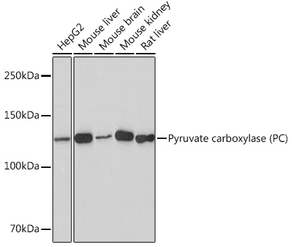 Pyruvate carboxylase (PC) Rabbit mAb