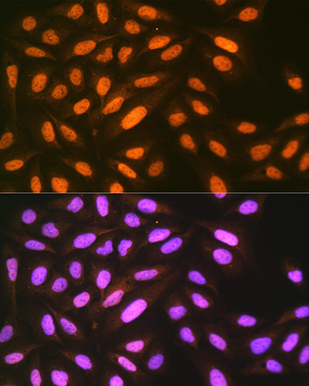 eIF4A3 Rabbit monoclonal antibody