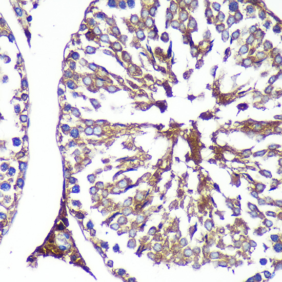 PASK Rabbit polyclonal antibody