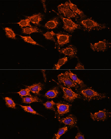 PASK Rabbit polyclonal antibody