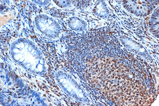 FEN-1 Rabbit monoclonal antibody