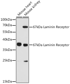 67kDa Laminin Receptor Rabbit polyclonal antibody