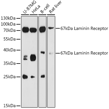 67kDa Laminin Receptor Rabbit polyclonal antibody