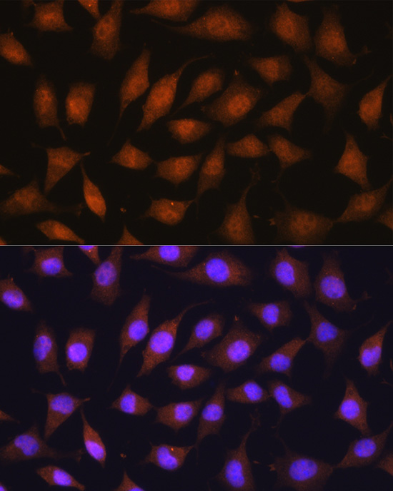 67kDa Laminin Receptor Rabbit polyclonal antibody