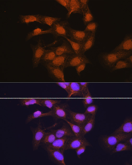 67kDa Laminin Receptor Rabbit polyclonal antibody