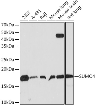 SUMO4 Rabbit monoclonal antibody