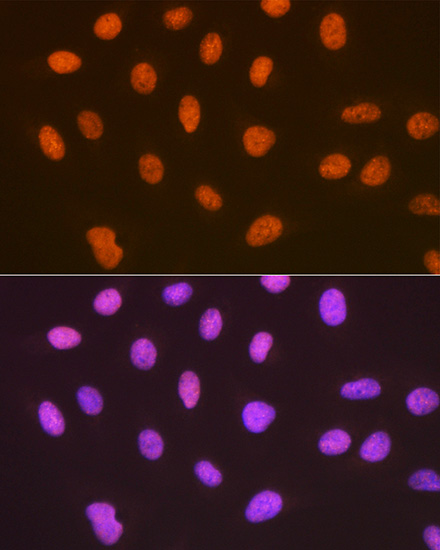 SUMO4 Rabbit monoclonal antibody