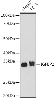 IGFBP2 Rabbit monoclonal antibody