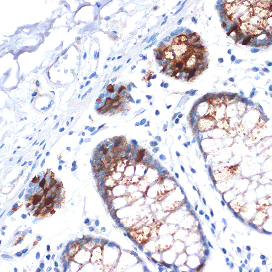 IGFBP2 Rabbit monoclonal antibody
