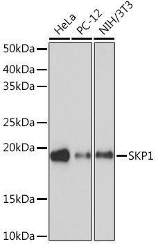 SKP1 Rabbit monoclonal antibody
