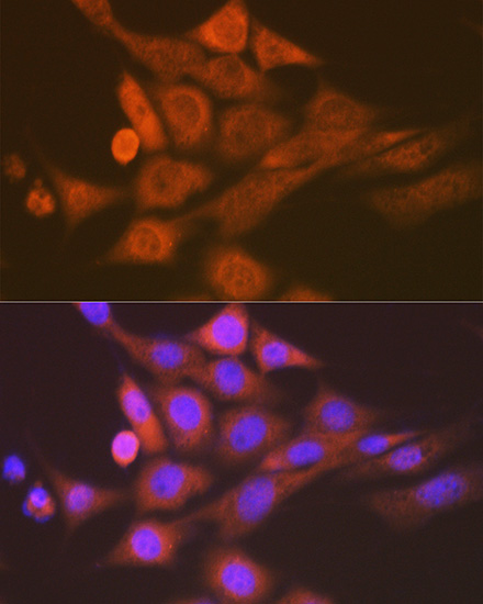 SKP1 Rabbit monoclonal antibody