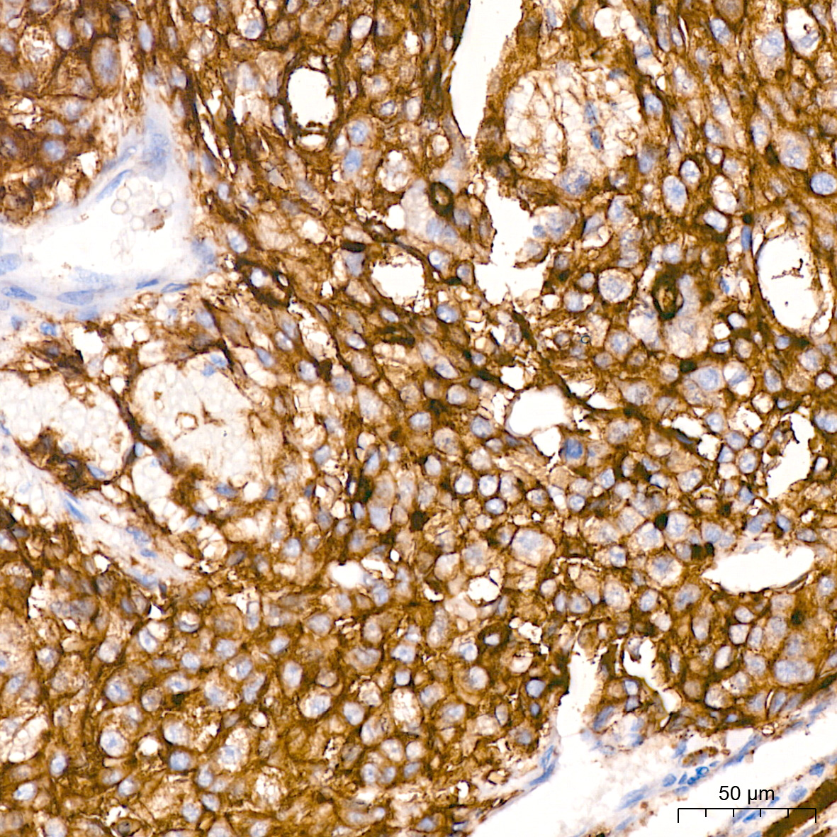 Xanthine Oxidase (XDH) Rabbit monoclonal antibody